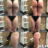 bioslimming06