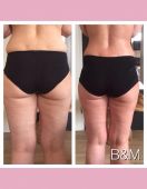 bioslimmingwrap