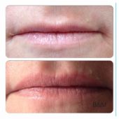 lipliner